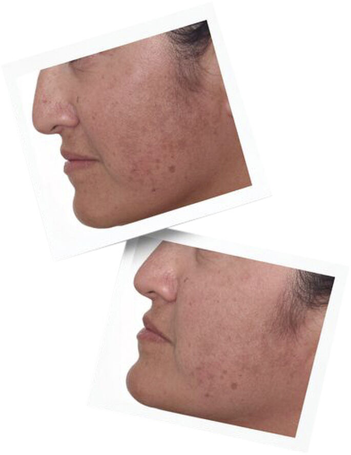 Murad Rapid Dark Spot Correcting Serum