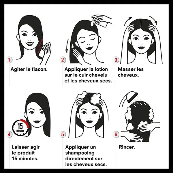 Loção antipiolhos e lêndeas Pouxit Extra Forte. Age em apenas uma aplicação de 15 minutos. Embalagem com 2 unidades de 100 ml.