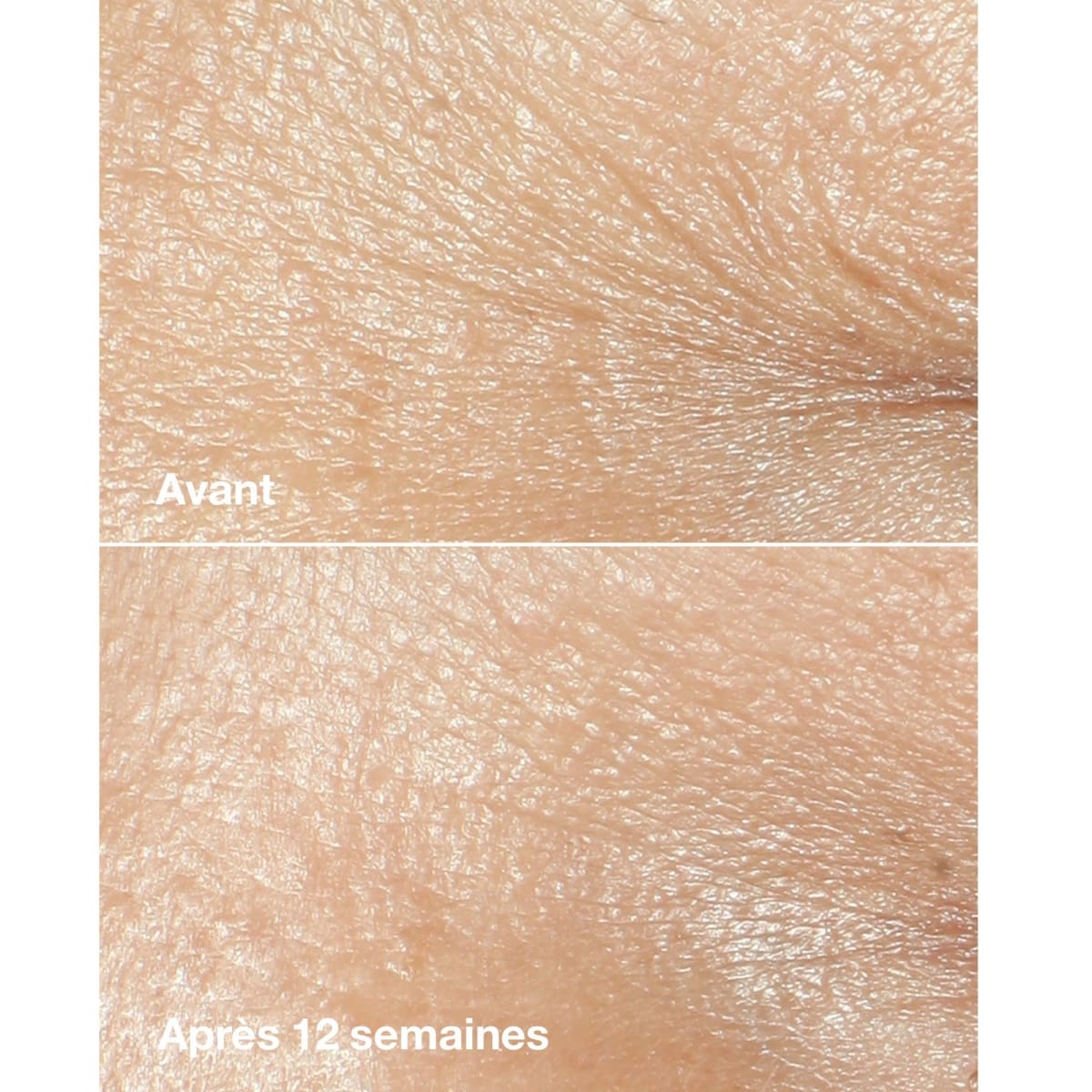 CLINIQUE Smart Clinical Repair Crème Riche Correctrice Anti-rides