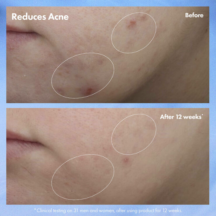 Origins Clear Improvement Acne & Blackhead Clearing Hydrating Moisturizer Loti