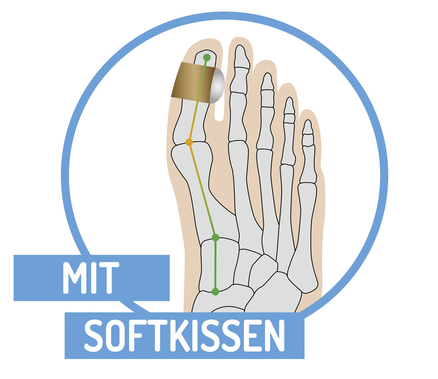 Zehenspreizer mit Fixierung