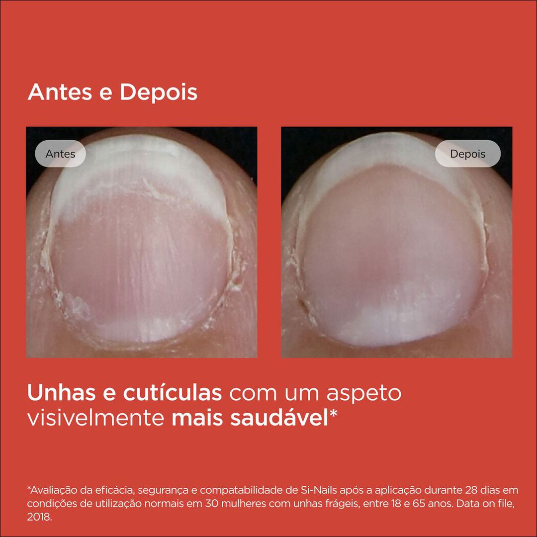 SI-NAILS  Verniz Ungueal Fortalecedor - 2,5ml
