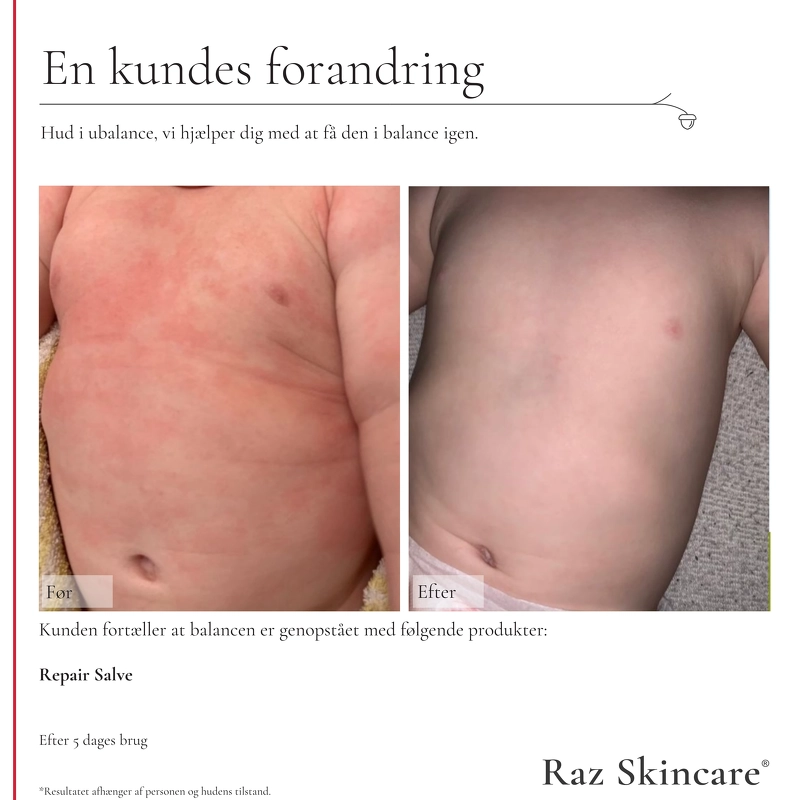 Raz Skincare Repair 100 ml