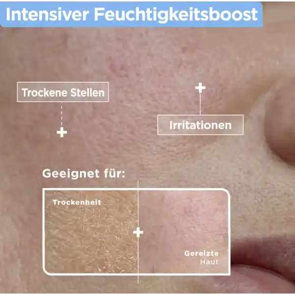 Anti-Trockenheit Serum