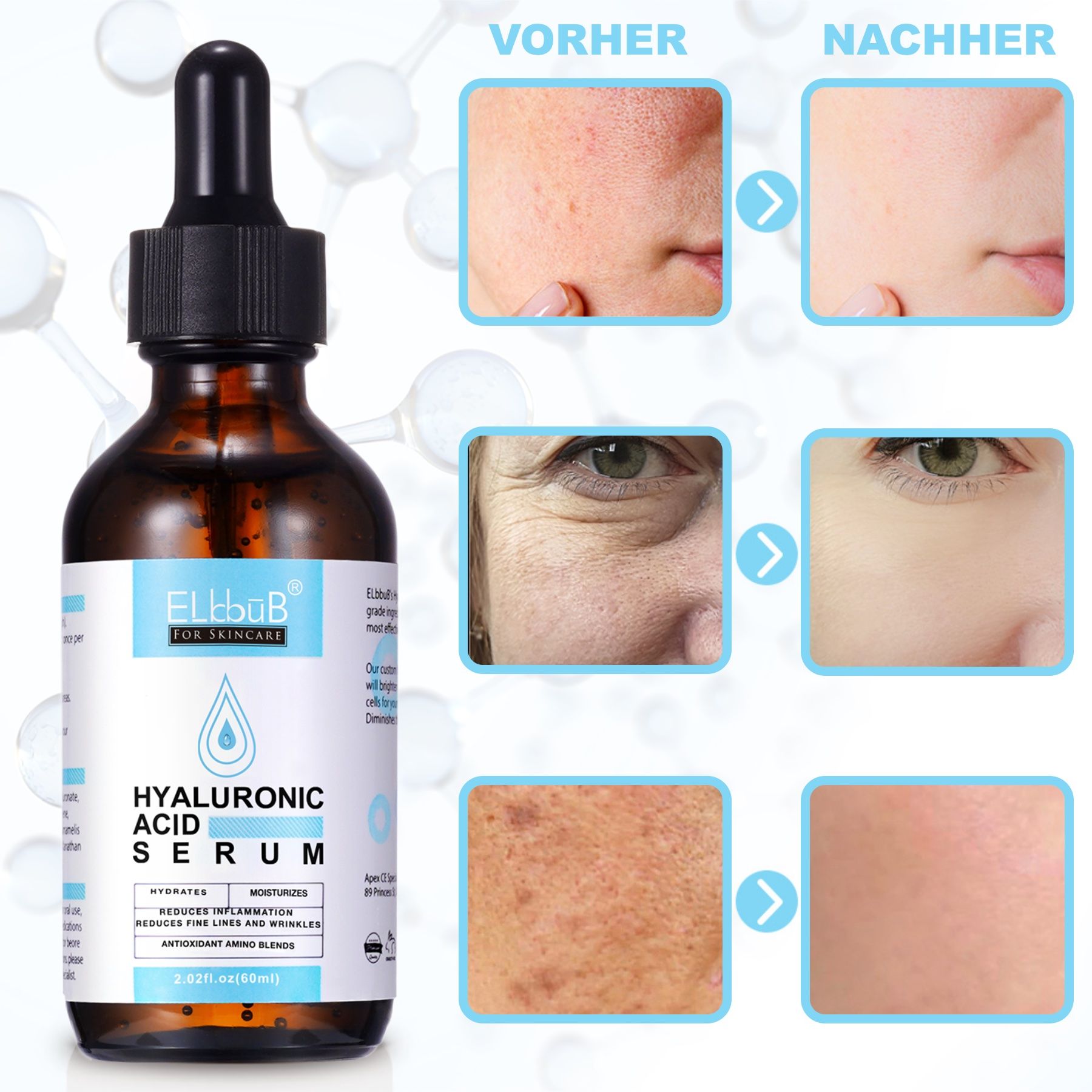 P-Beauty Cosmetic Accessories Gesichtsserum mit Hyaluronsäure