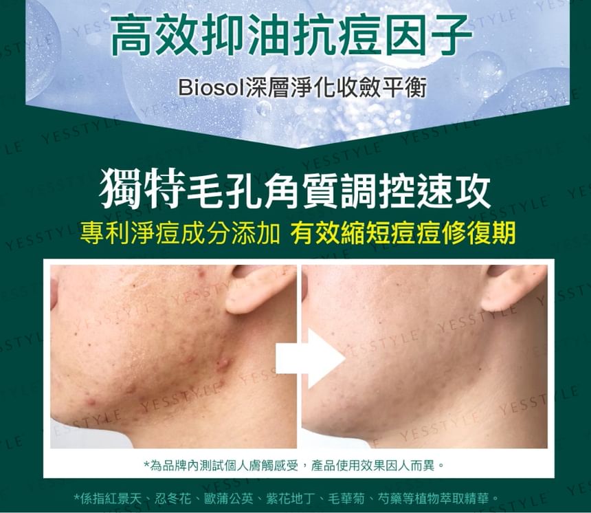 PEZRI - Acne Care Zuiverende Mousse Reiniger
