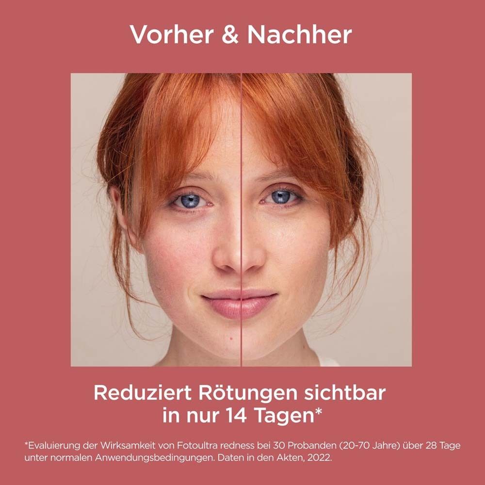 ISDIN Fotoultra Redness Sonnencreme Gesicht LSF50 bei sehr empfindlicher Haut, Rosazea und Couperose