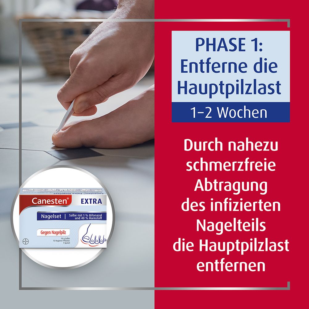 Canesten® EXTRA Nagelset zur Behandlung von Nagelpilz