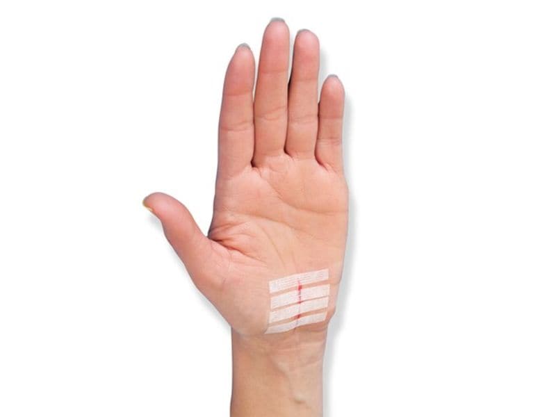 3M Nexcare Steri-Strip Wundverschlusstreifen weiss, 8 Stück Verschlussstreifen für Wunden