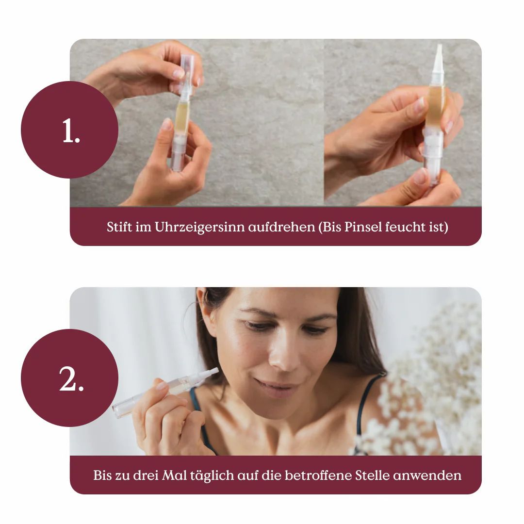 Health Routine Skin Care Pen / Bei Hautunreinheiten (Pickel, Akne)