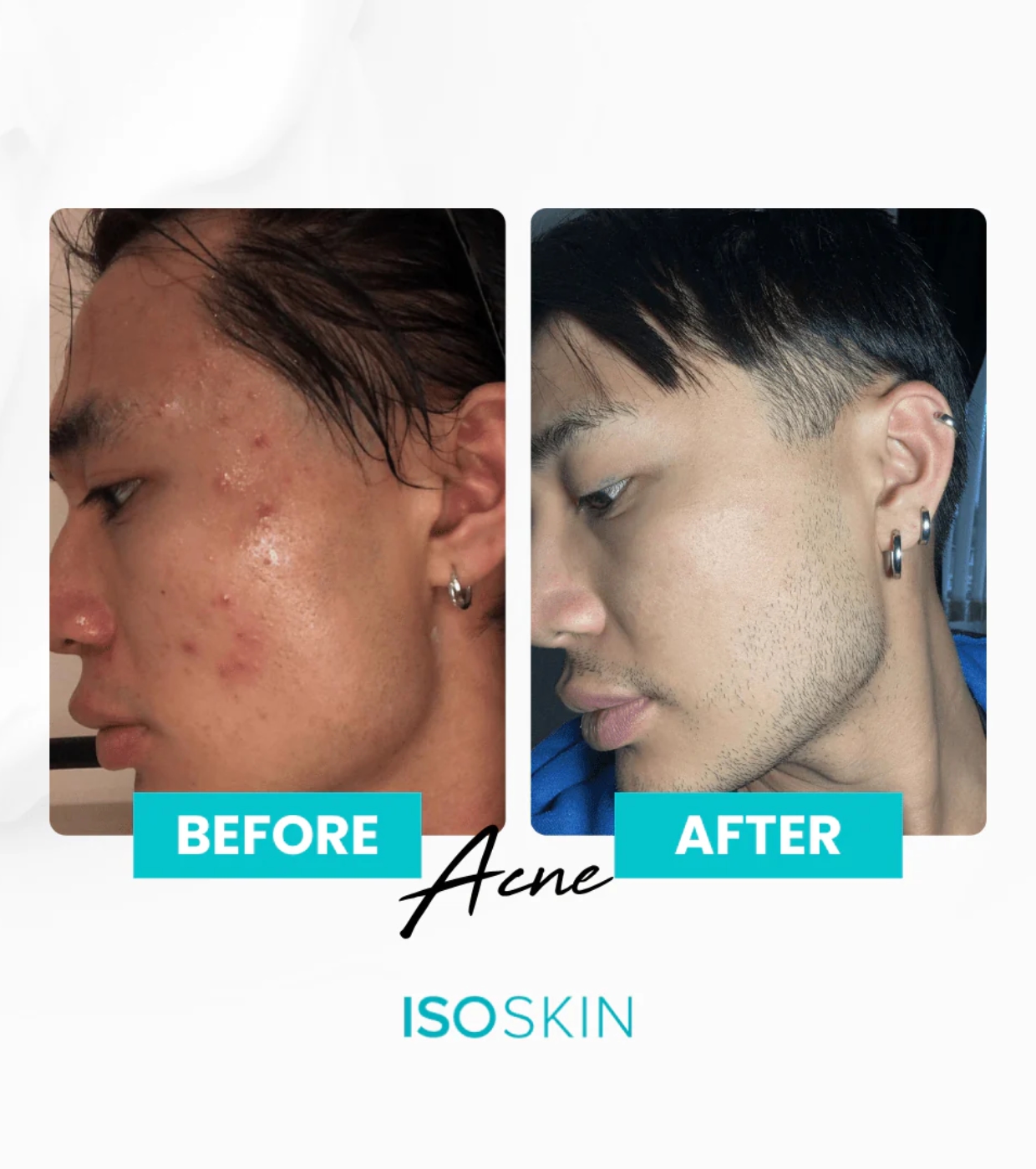 ISOCLEAN - *ISOSKIN* - Spray facial e corporal Hypochlorous - 100ml