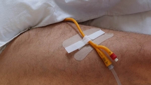 SECUTAPE Fixierset für grosse Lumina Vlies, 10 Stück