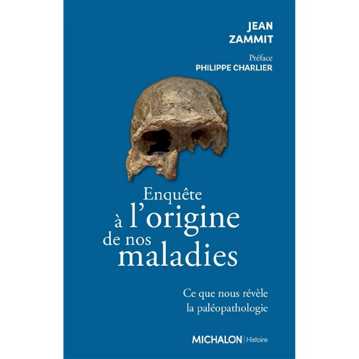 Enquête à l'origine de nos maladies : ce que nous révèle la paléopathologie