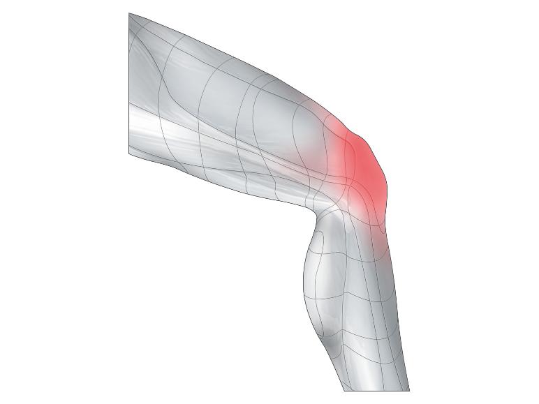 Kniebrace