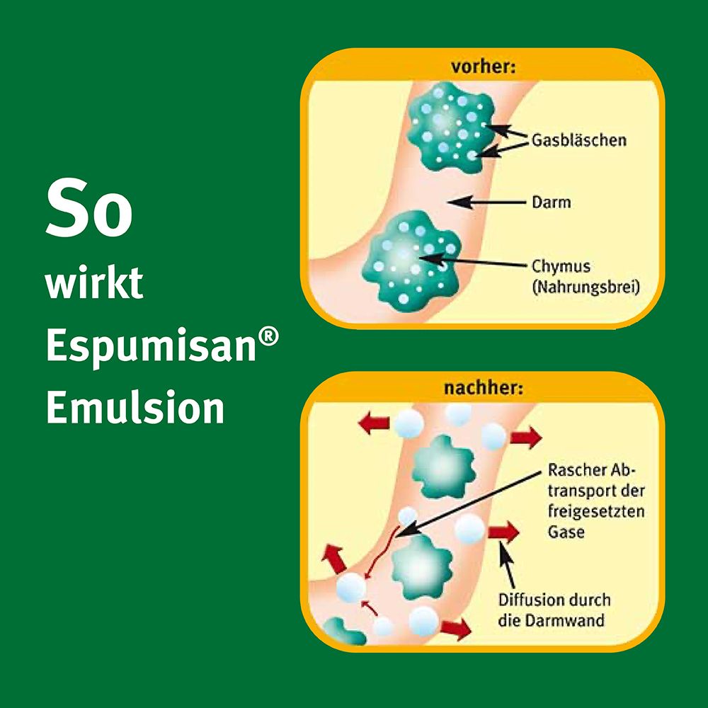 Espumisan® Emulsion