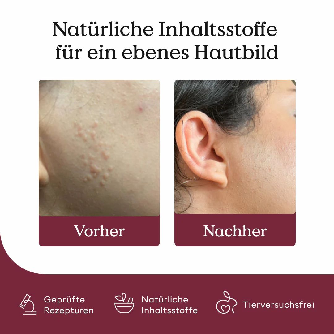 Health Routine Skin Care Pen / Bei Hautunreinheiten (Pickel, Akne)