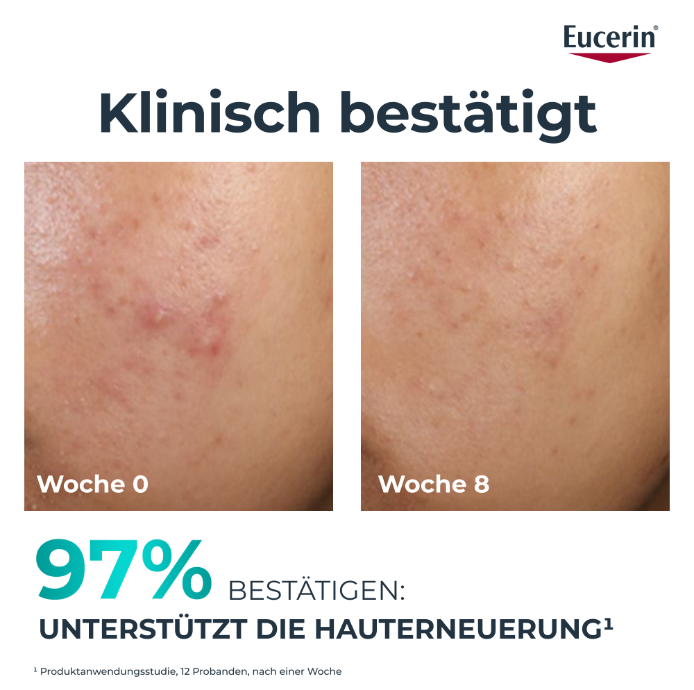 EUCERIN Dermopure Clinical Peeling 10 Nachtpflege<br>40 ml, hautbilderneuernd
