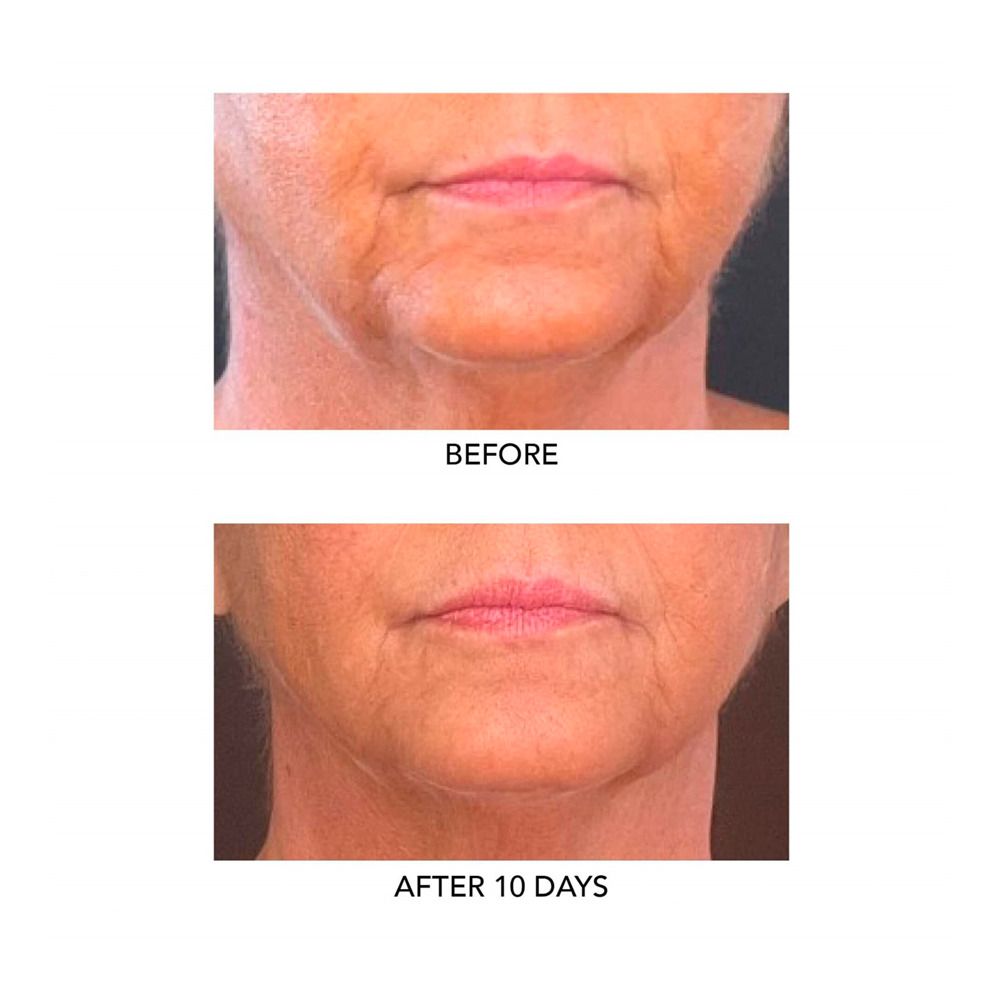 Algenist Genius Liquid Collagen - 30 ml.