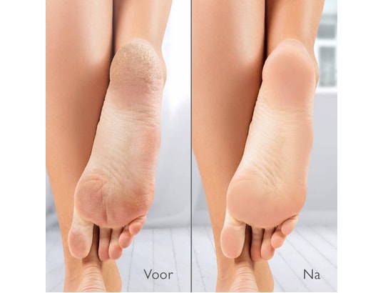 SILK'N - Râpe électrique avec système d'aspiration black vacupedi vp...