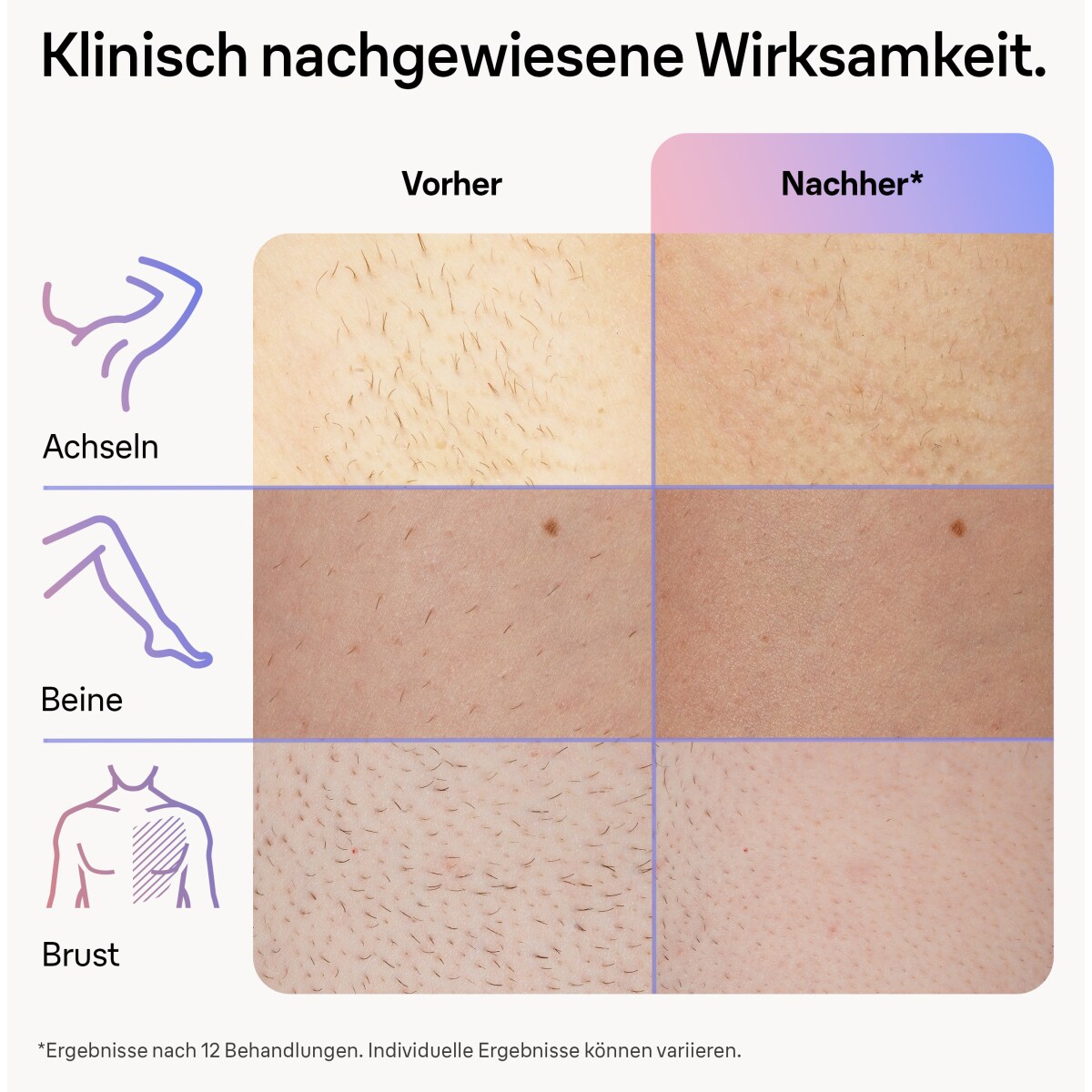 Braun Skin i-expert Haarentfernung Pro IPL PL7147