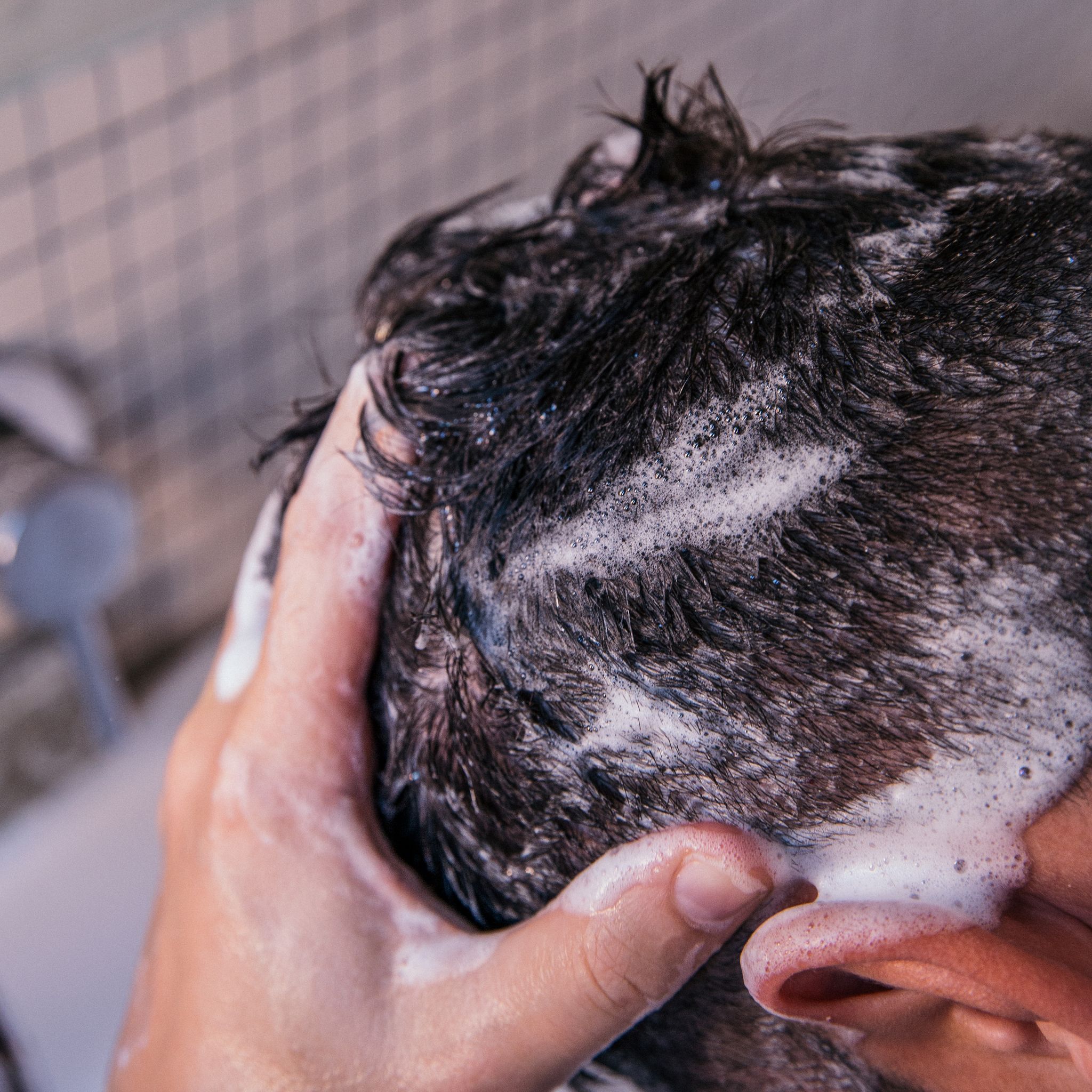 SOBER BERLIN FOLLICLE TREATMENT
