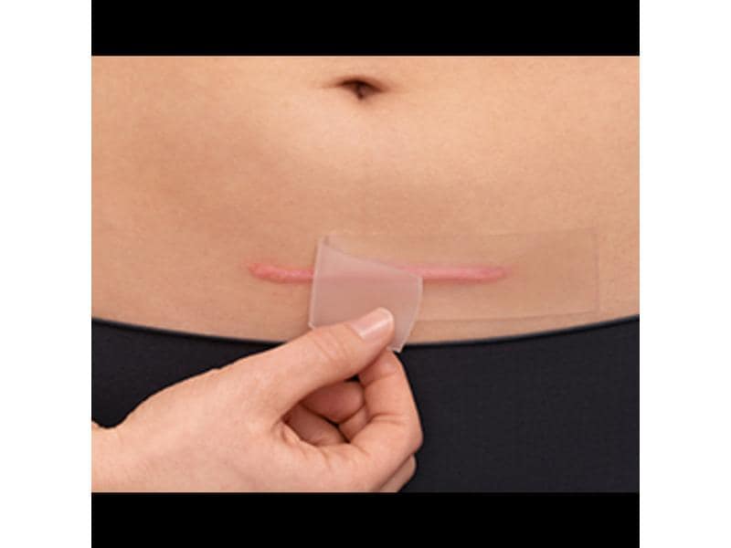 Hansaplast Narbenpflaster Narben Reduktion XL 21 Stück Pflaster zur Narbenbehandlung