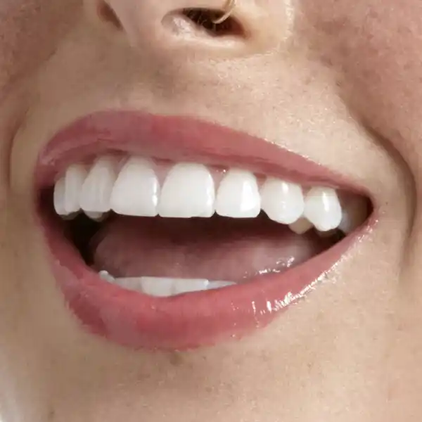 Butter Gloss 36 Sorbet