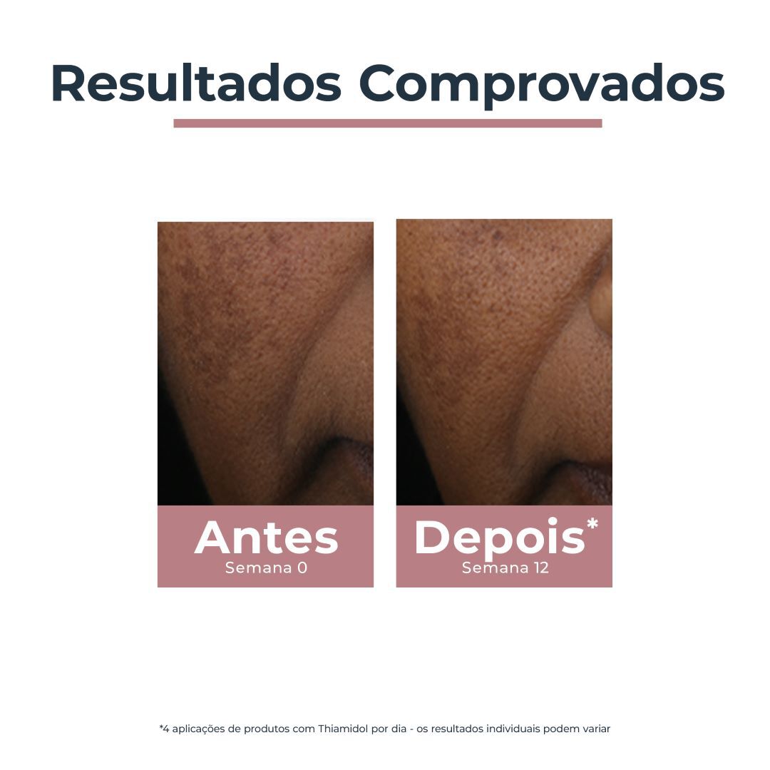 EUCERIN  Anti-Pigment Corretor Localizado de Manchas - 5ml