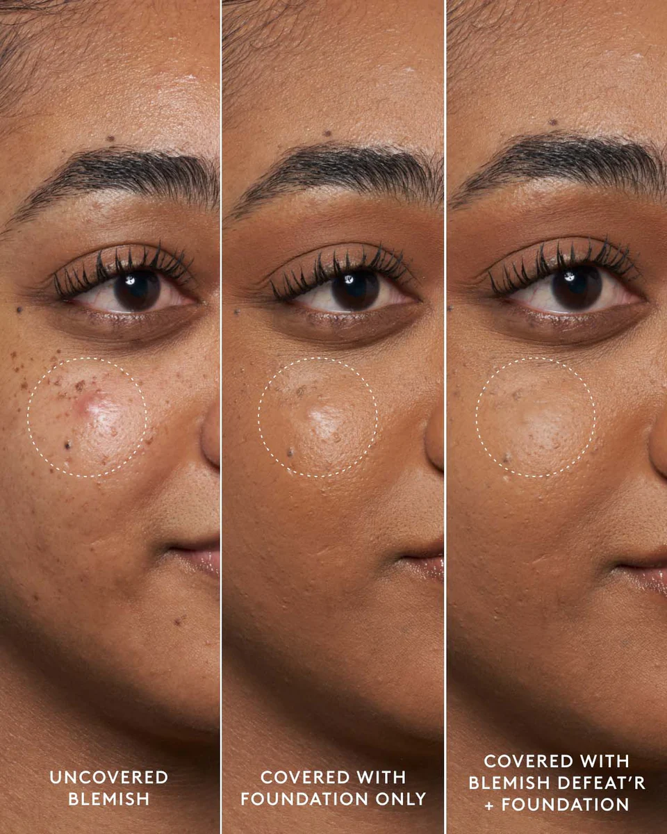 Blemish Defeat'r BHA Spot-Targeting Gel