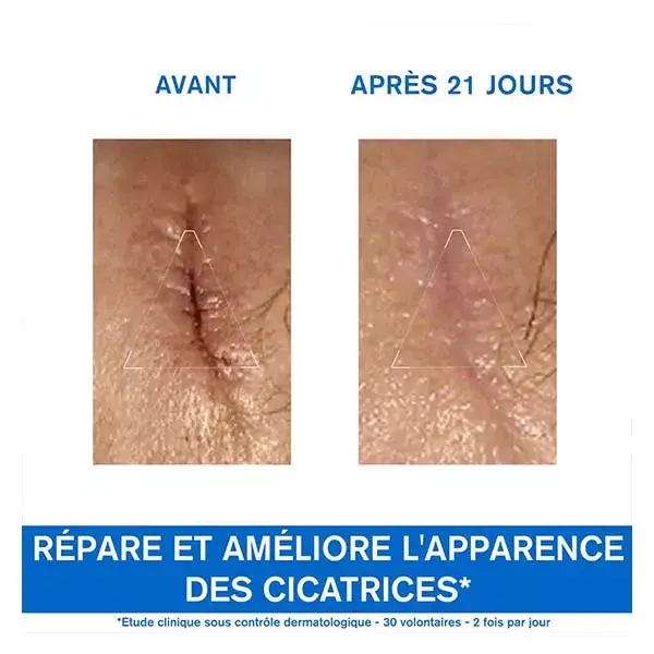 Uriage Bariéderm-Cica Crème Cuive-Zinc Réparatrice Peaux Abimées 40 ml