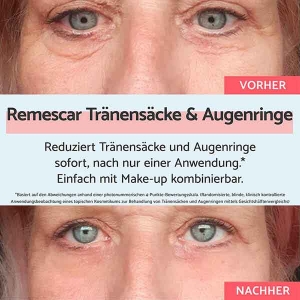 REMESCAR Tränensäcke und Augenringe, 8 ml