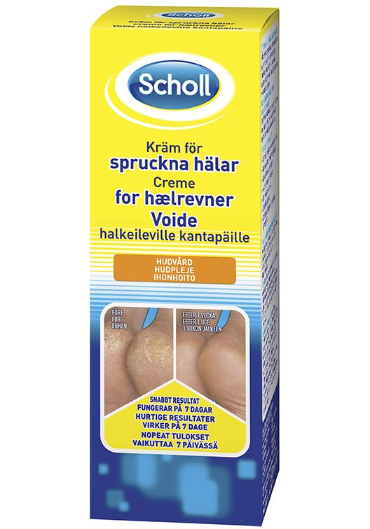 Krem for sprukne hæler