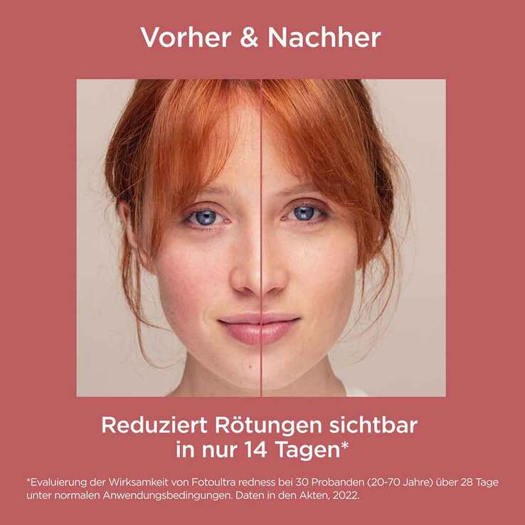 ISDIN Fotoultra Redness Creme LSF 50, 50 ml