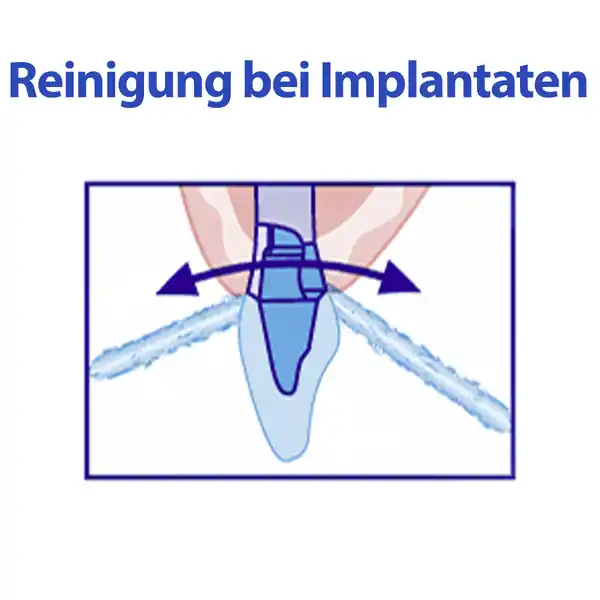 Spezial-Flauschfäden