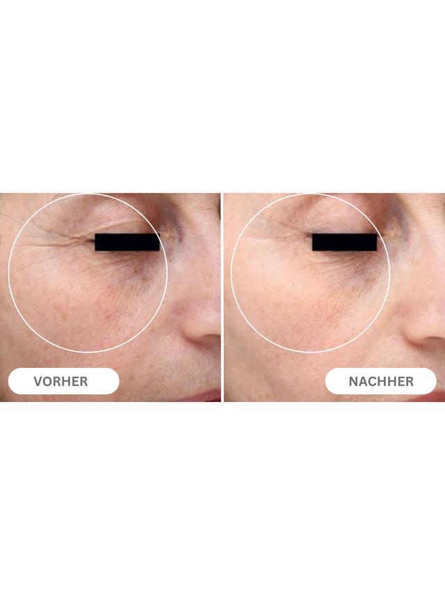 Natural Botulin Liftingcreme