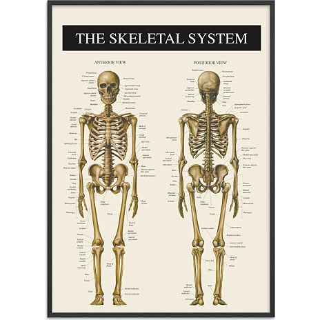 Skelettet 2 - 70x100 cm