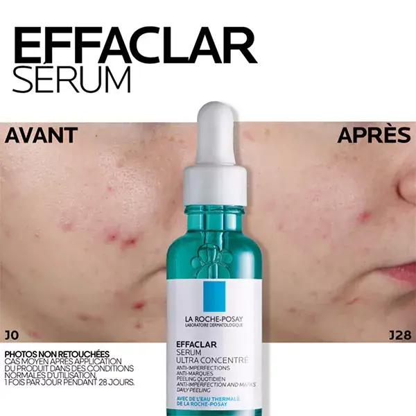 Sérum Anti-Imperfeições Effaclar da La Roche-Posay (30ml) e Protetor Solar Facial Anthelios UVMune 400 Oil Control FPS 50+ (50ml)