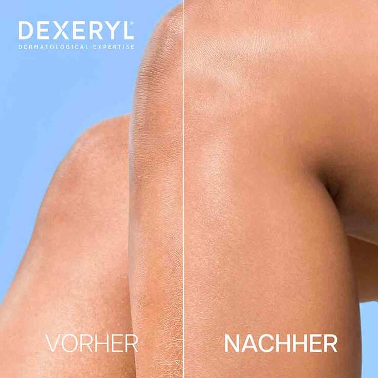 Dexeryl Shower Duschcreme, 500 ml