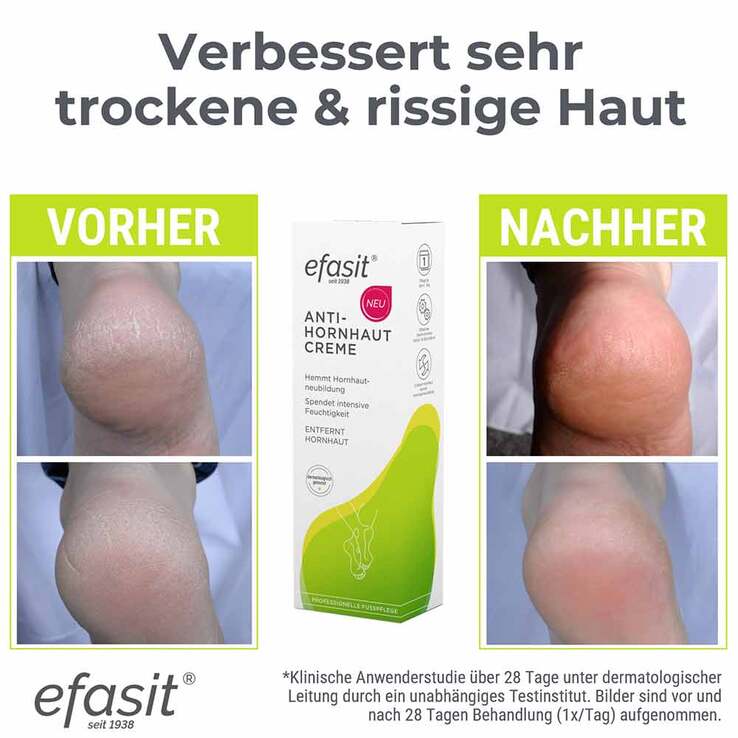 Efasit Anti-Hornhaut Creme, 75 ml