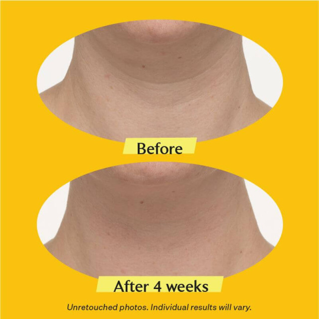 TL Advanced Crème raffermissante pour le cou STRIVECTIN