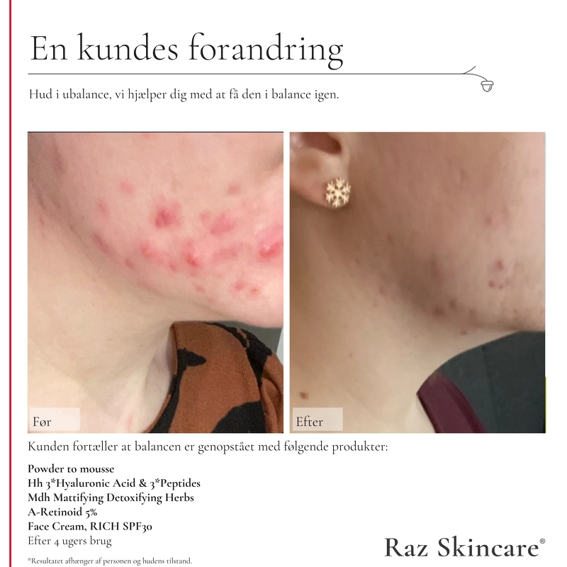 Raz Skincare Face Cream SPF 30 Rich 50 ml