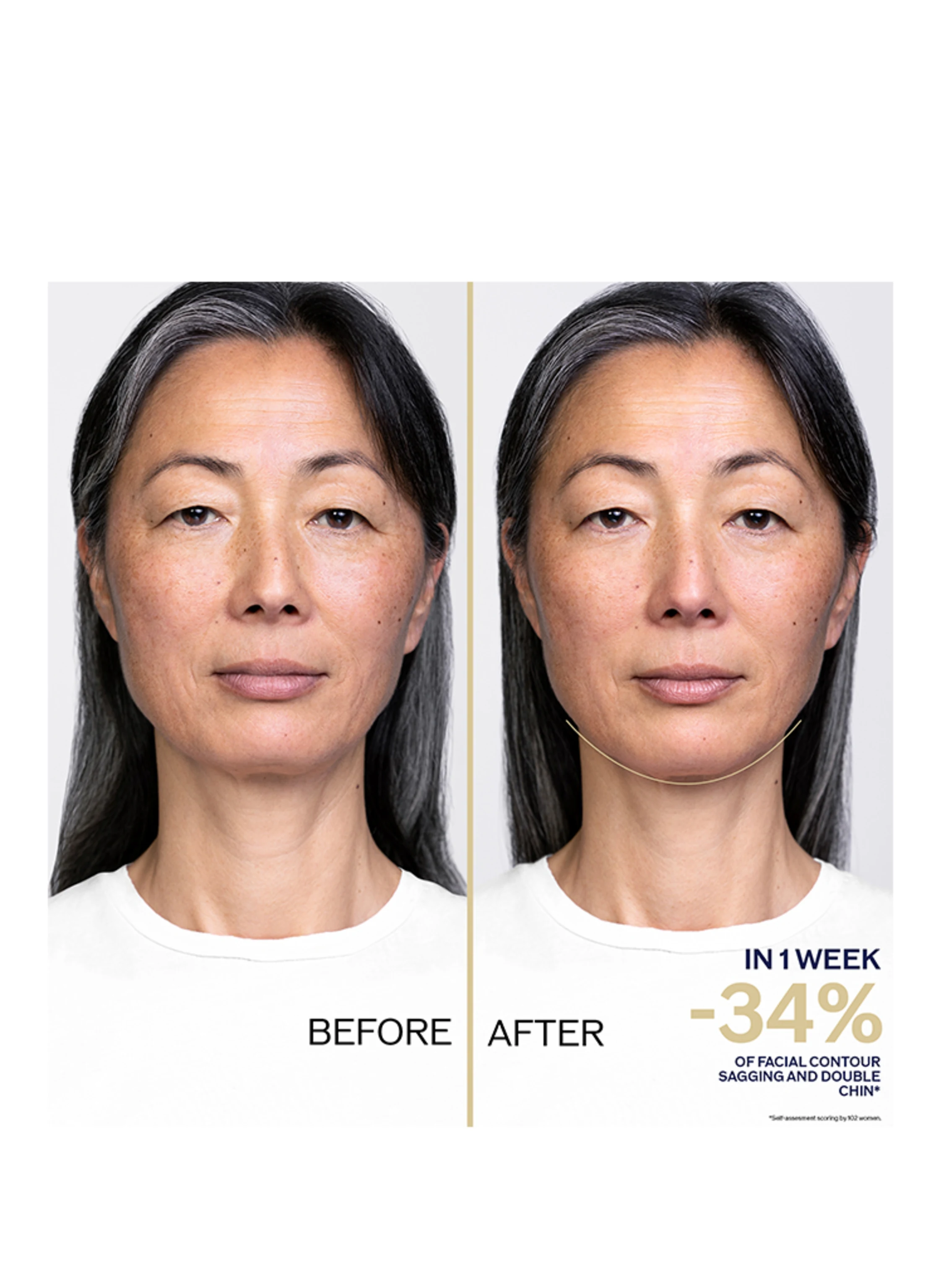 SHISEIDO VITAL PERFECTION