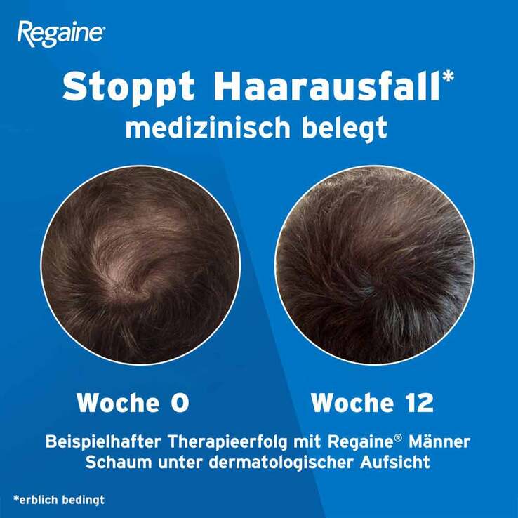 Regaine Männer Lösung, 2x3x60 ml