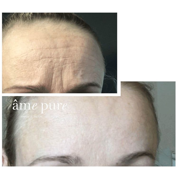 âme pure WrinklEraser BASIC