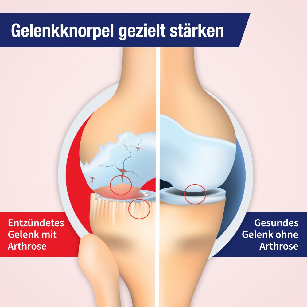 GELENCIUM® Arthro - pflanzliche Tropfen bei Arthrose