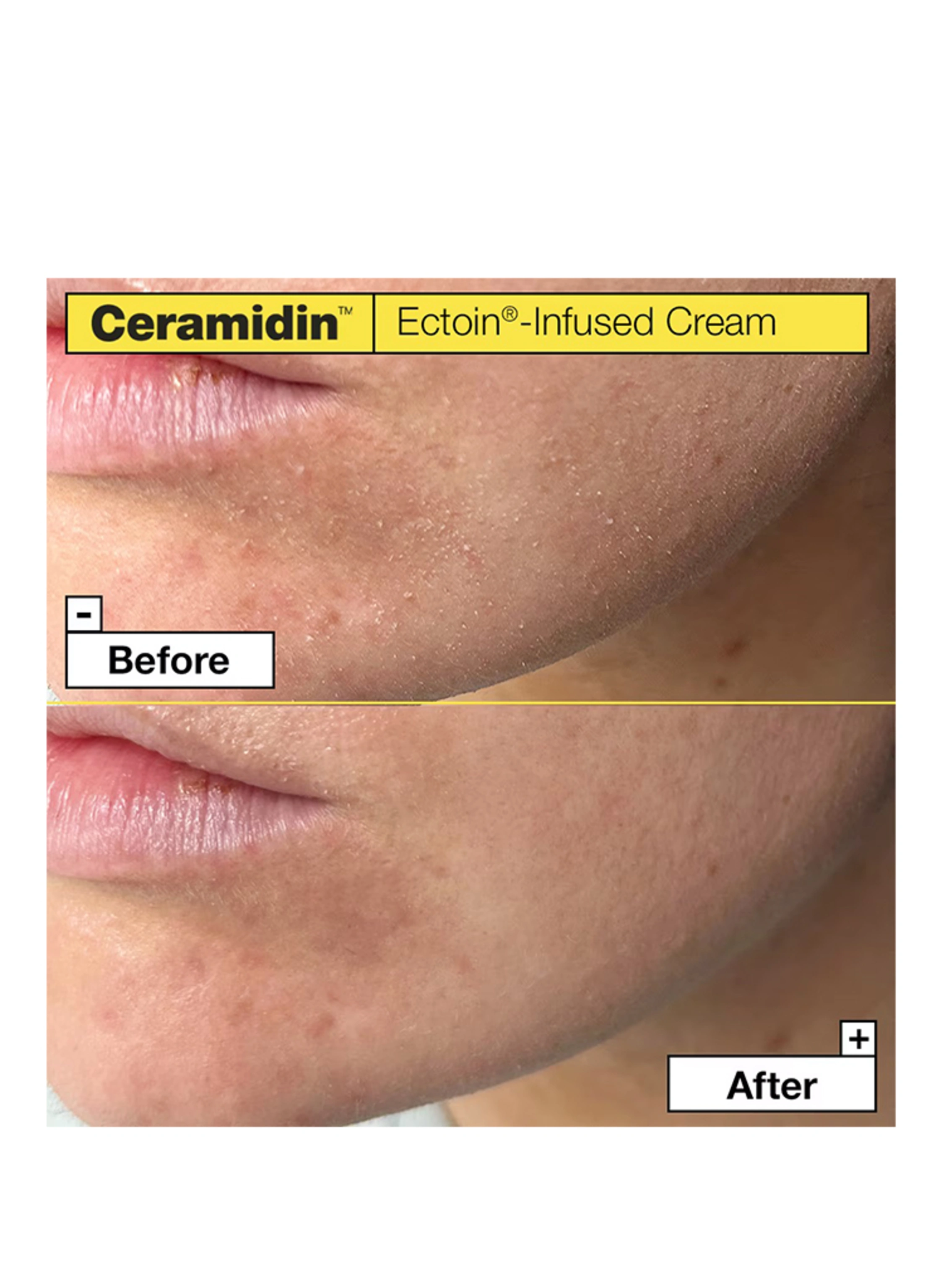 Dr.Jart+ CERAMIDIN ECTOIN-INFUSED CREAM