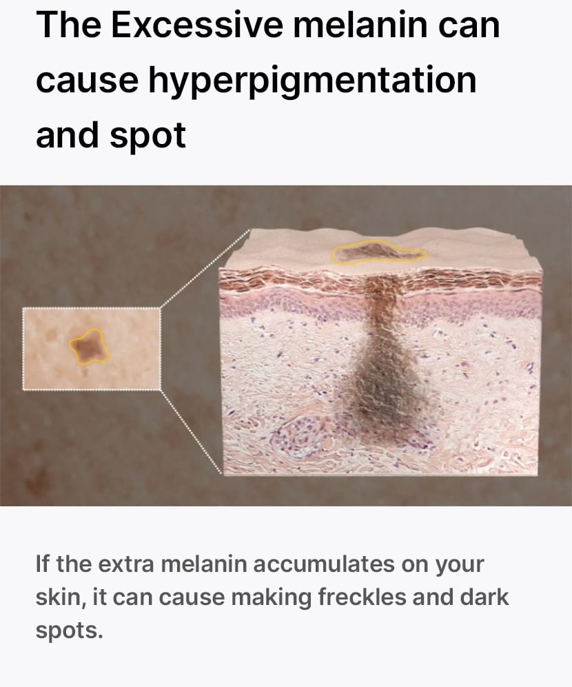 celimax - Porie + Donkere Vlekken Verhelderend Serum Mini