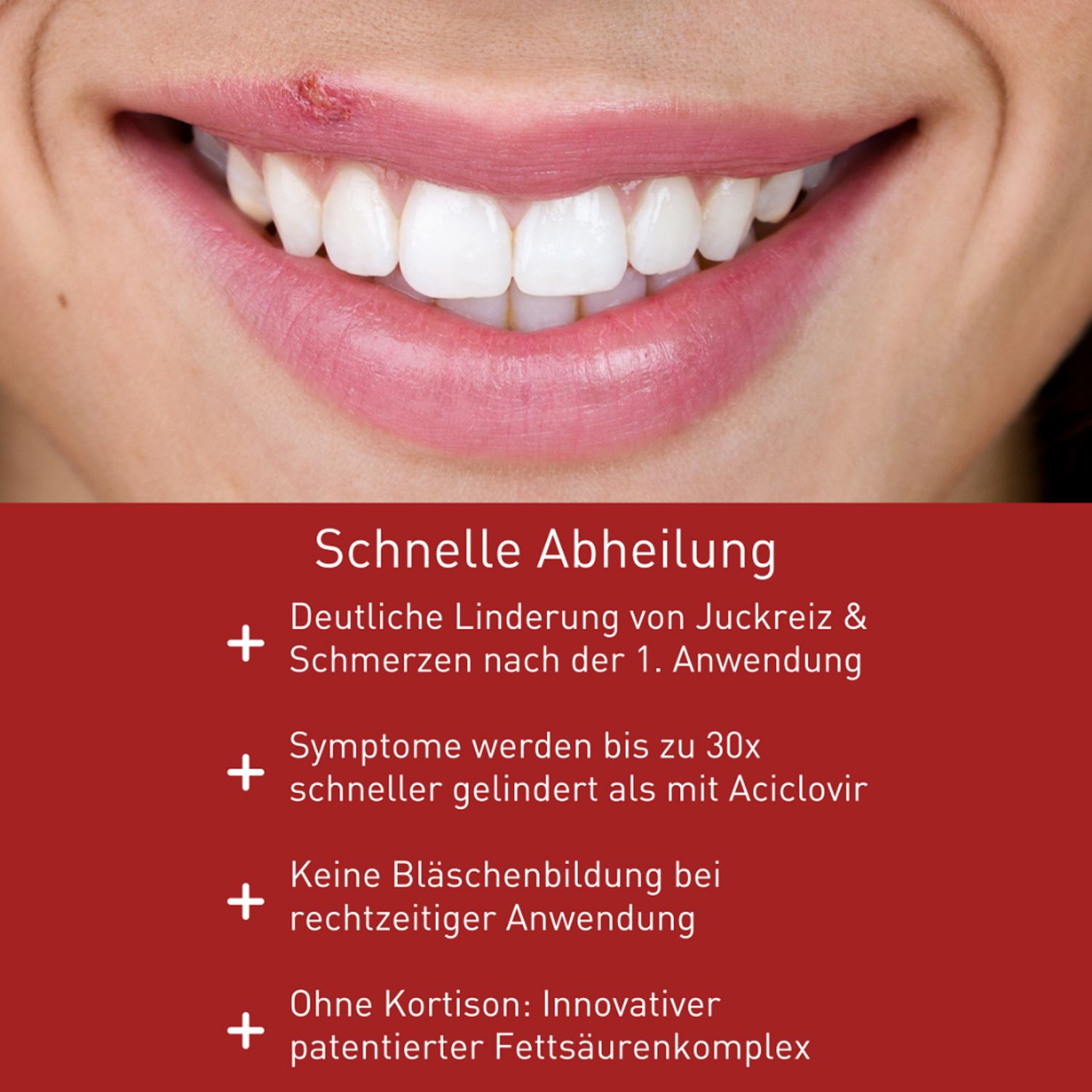 N1 Herpes Creme mit Soforteffekt . Innovativer Fettsäurenkomplex