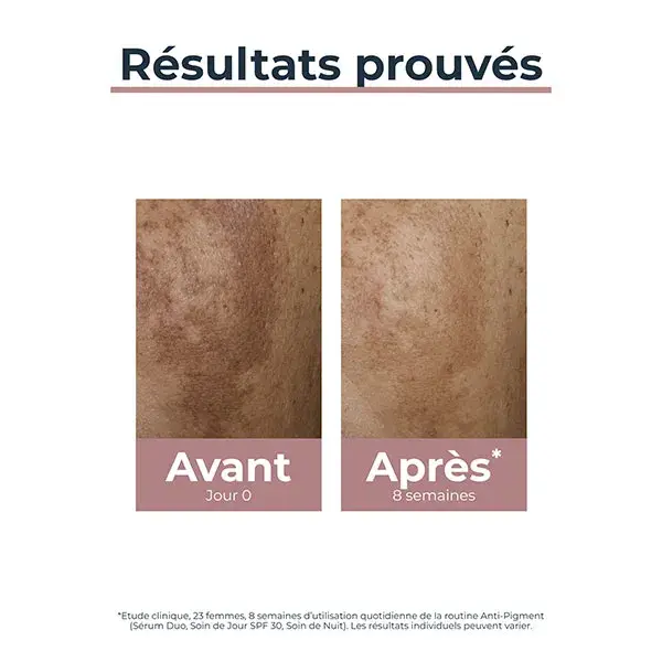 Eucerin Anti-Pigment Soin de Jour Anti-Taches SPF30 50ml