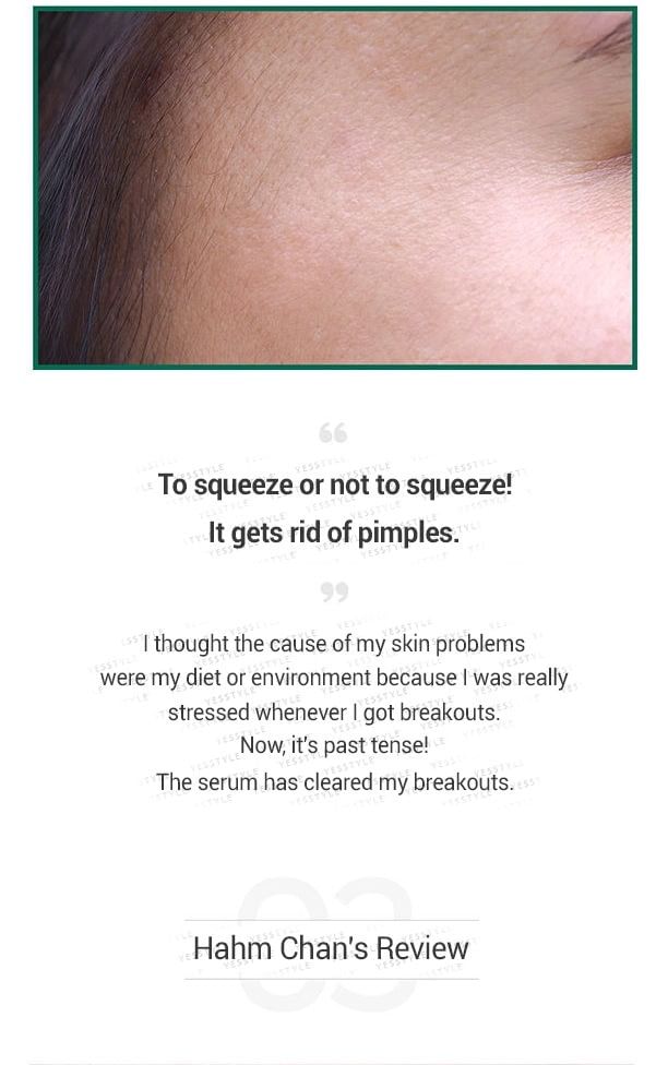 SOME BY MI - AHA, BHA, PHA 30 Dagen Wonder Serum 50ml